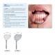 Retractor and Mouth Mirror