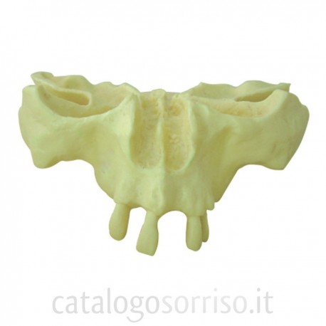 Modelli (TP) impiantologia: