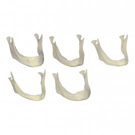 Set modelli di impiantologia 