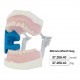Apribocca in silicone